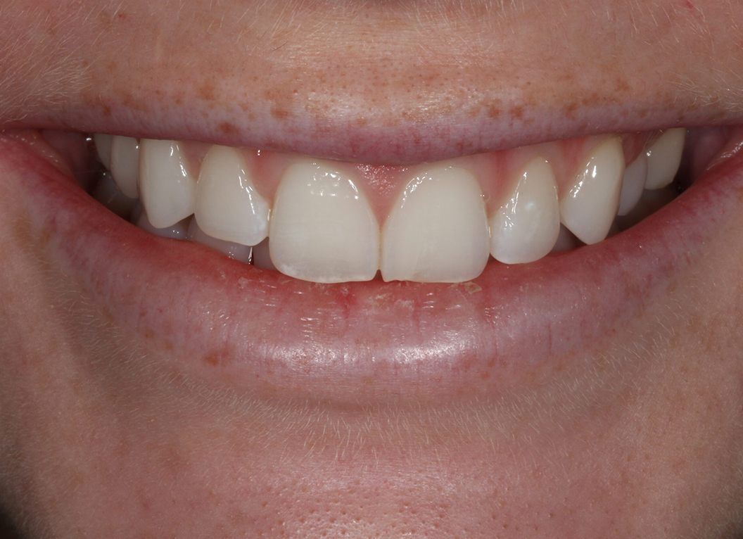 Before - The White House Dental