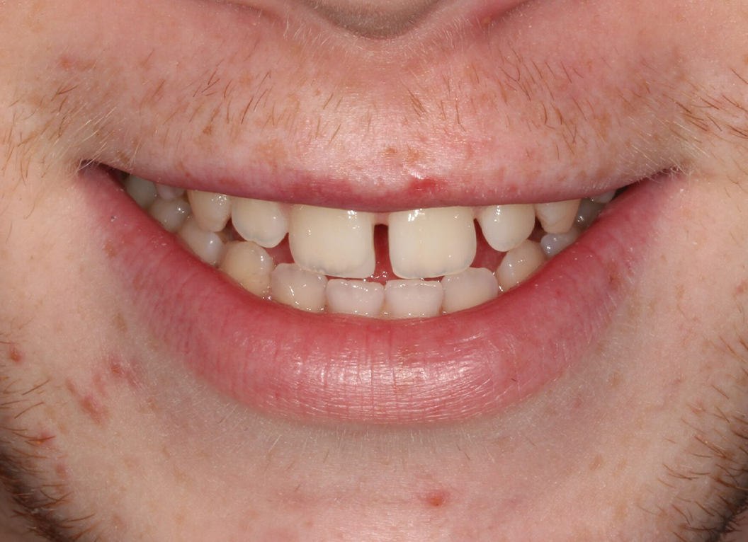 Before - The White House Dental