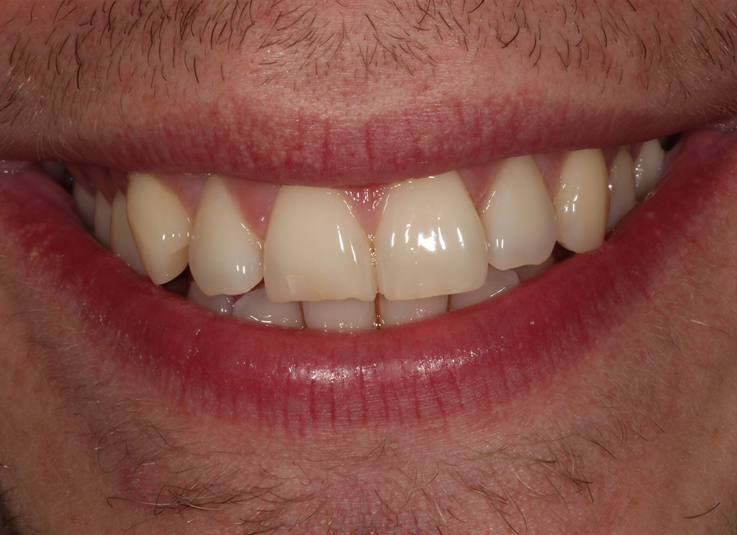 Before - The White House Dental