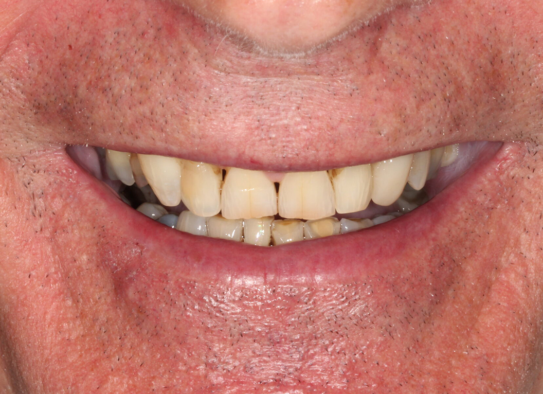 Before - The White House Dental