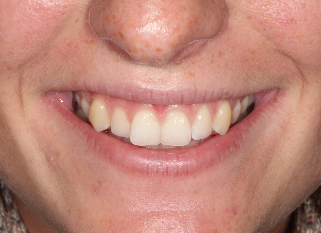 Before - The White House Dental