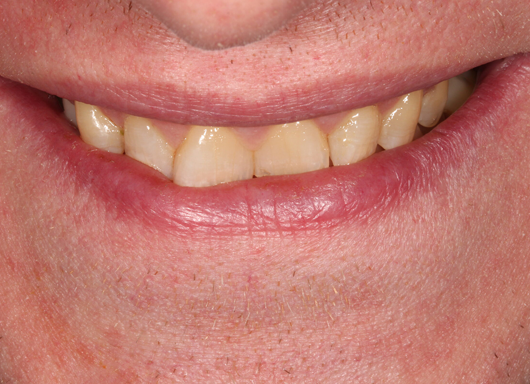 Before - The White House Dental