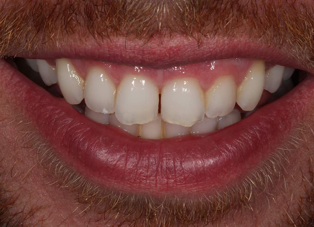 Before - The White House Dental