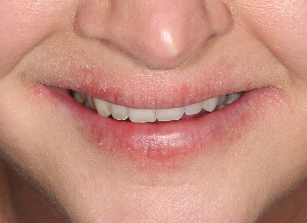 Before - The White House Dental