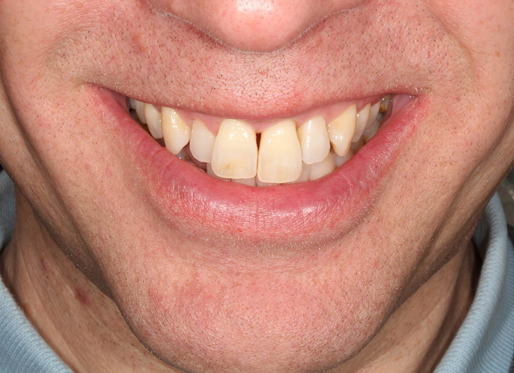 Before - The White House Dental