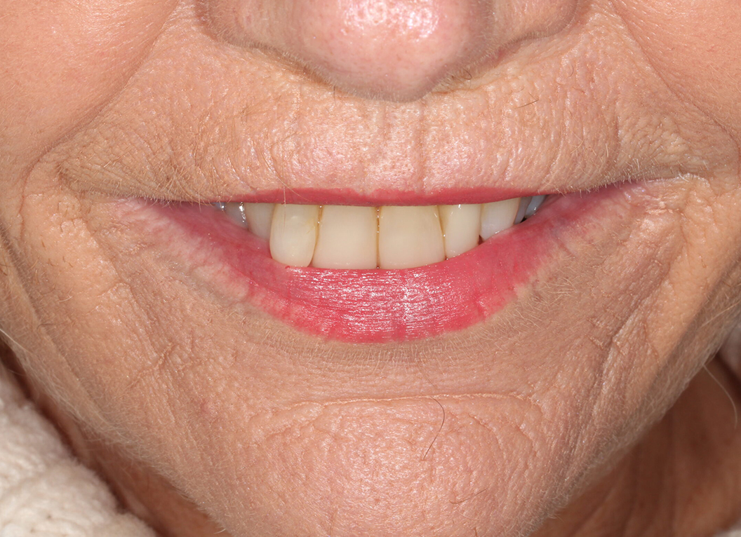 After - The White House Dental