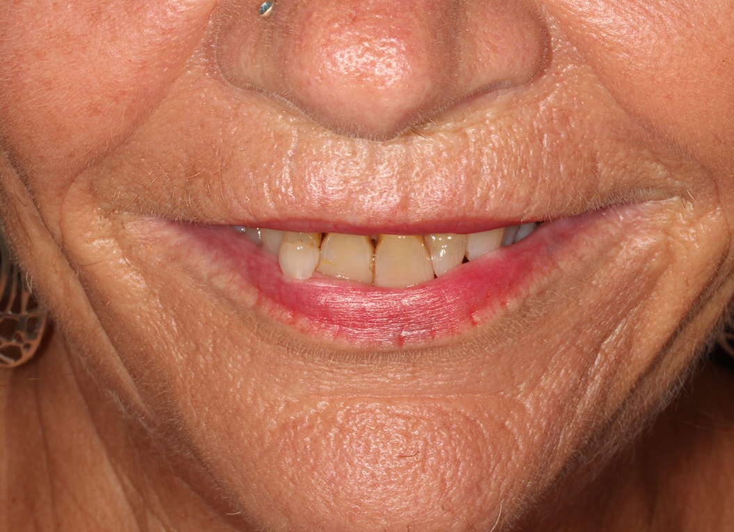 Before - The White House Dental