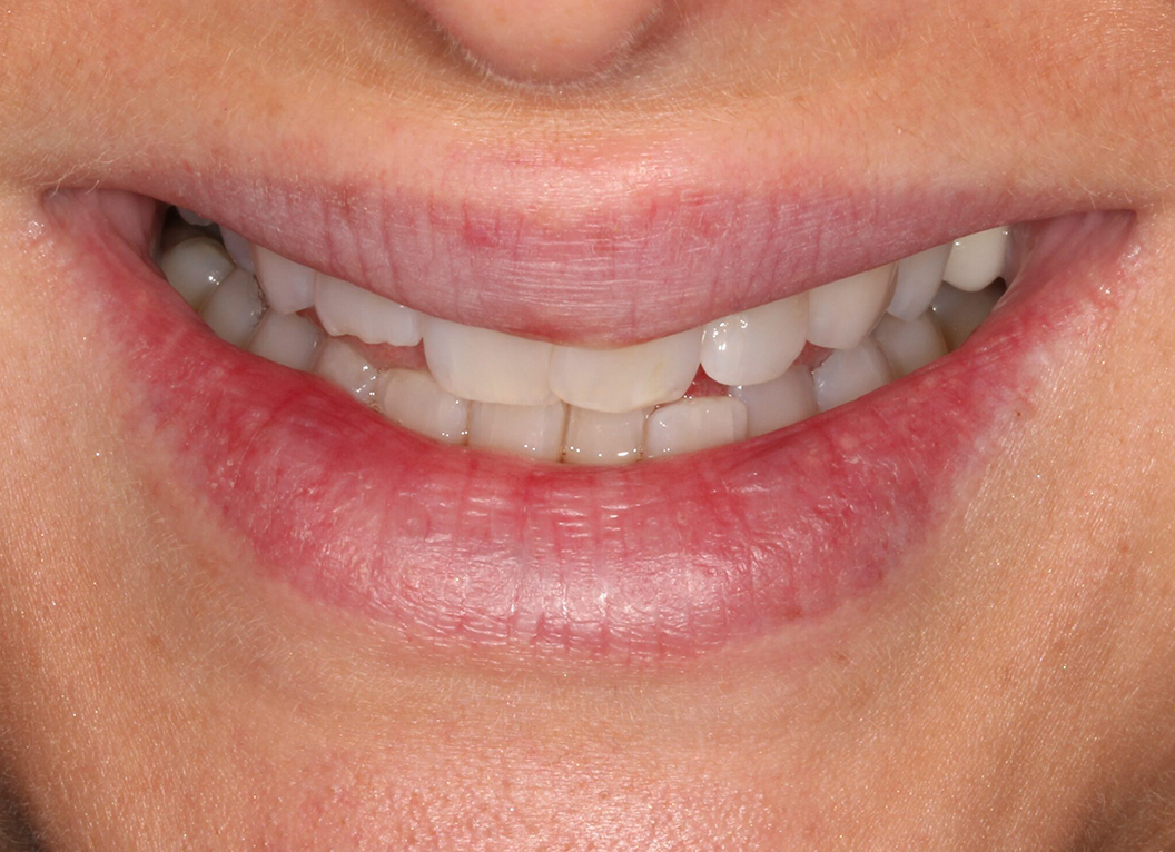 Before - The White House Dental