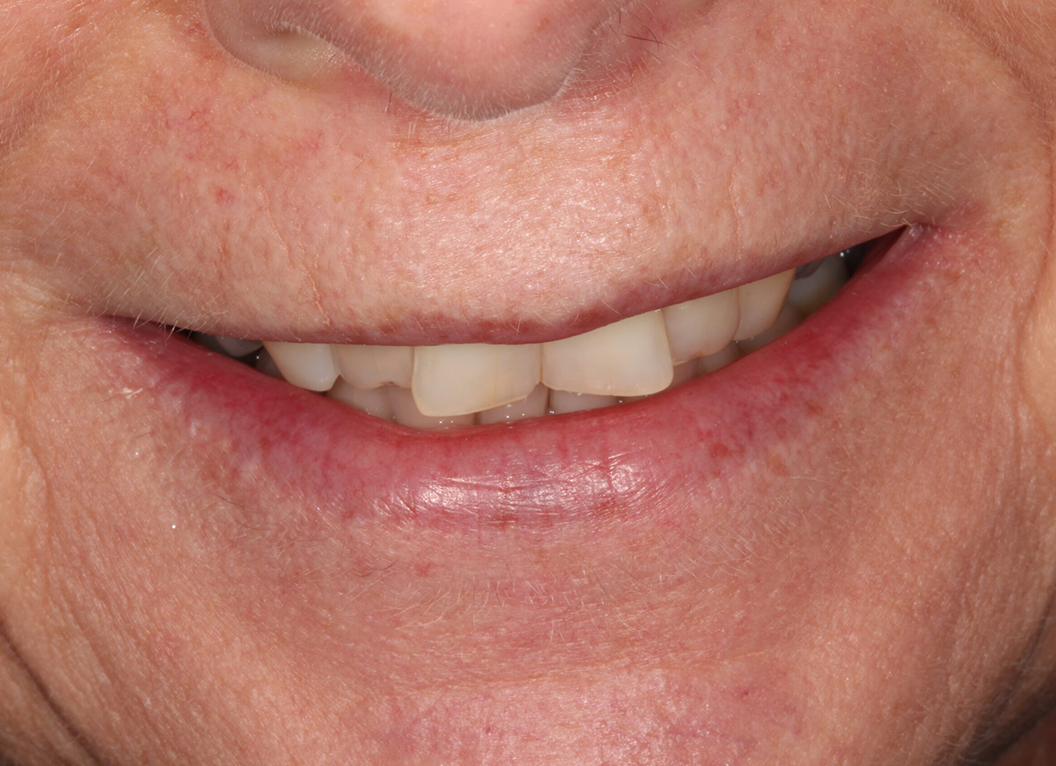 Before - The White House Dental